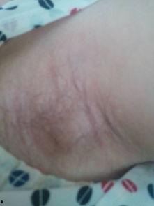 腋下淋巴结图片,揭秘人体免疫系统的重要关卡