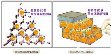 韩国dh整形,引领美容潮流的尖端技术解析