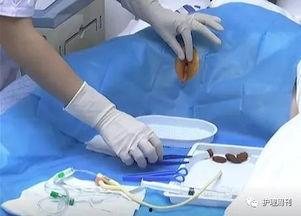 导尿管视频,导尿管操作步骤及注意事项详解