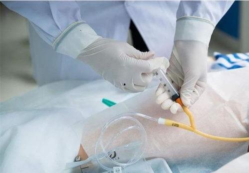 导尿管视频,导尿管操作步骤及注意事项详解