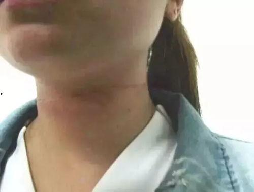 女性正常脖子图片大全,从图片大全看颈部线条与气质